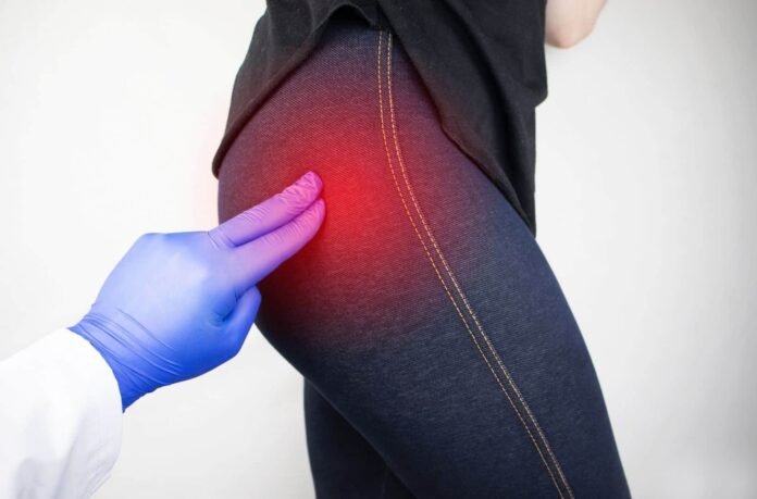 hip bursitis treatment
